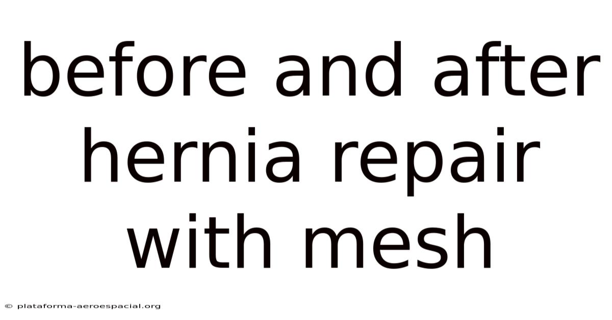 Before And After Hernia Repair With Mesh