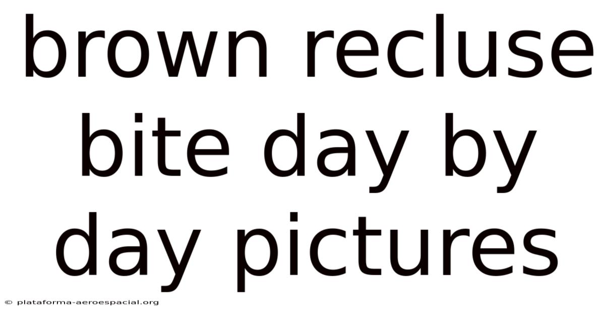 Brown Recluse Bite Day By Day Pictures