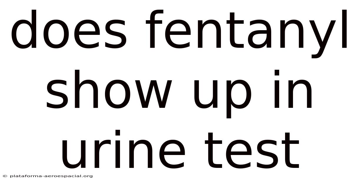 Does Fentanyl Show Up In Urine Test