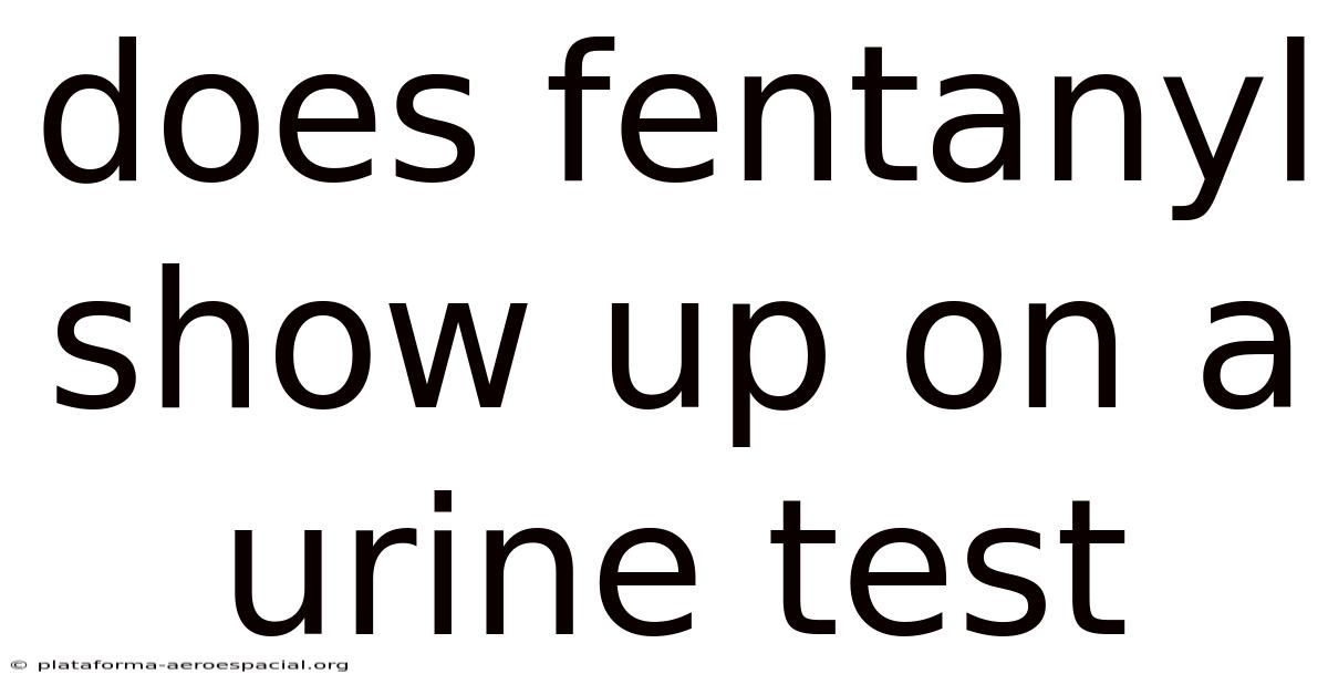 Does Fentanyl Show Up On A Urine Test