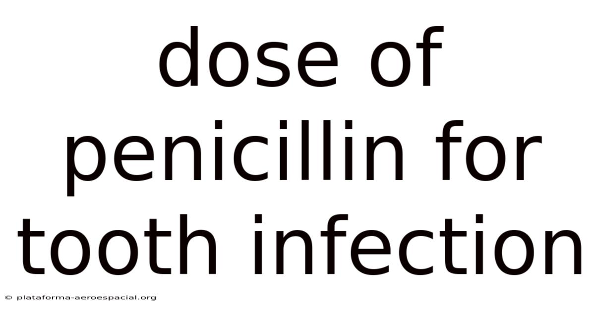 Dose Of Penicillin For Tooth Infection