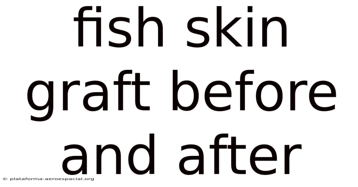 Fish Skin Graft Before And After