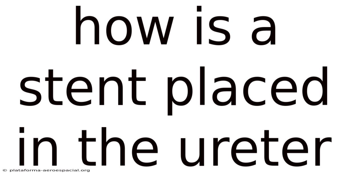 How Is A Stent Placed In The Ureter