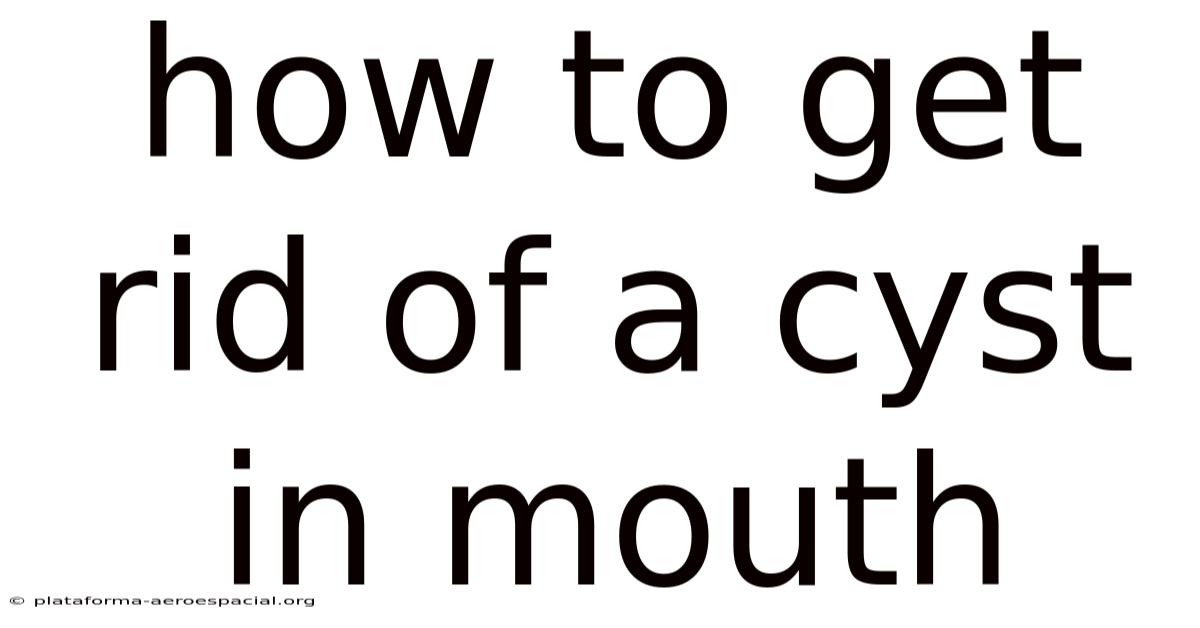 How To Get Rid Of A Cyst In Mouth
