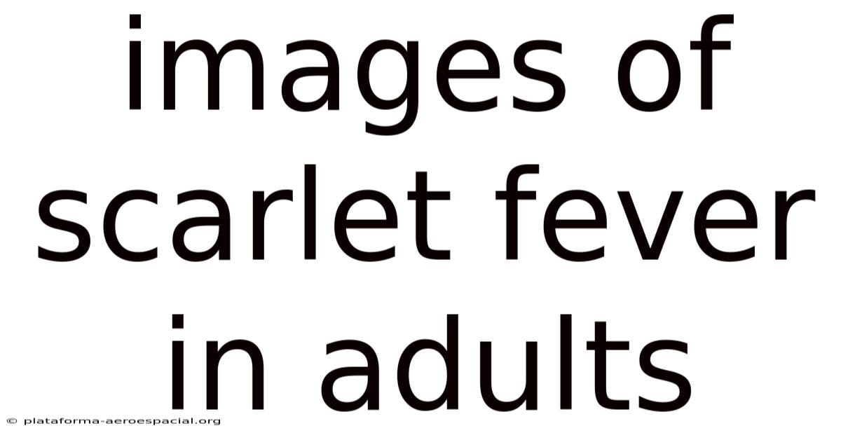 Images Of Scarlet Fever In Adults
