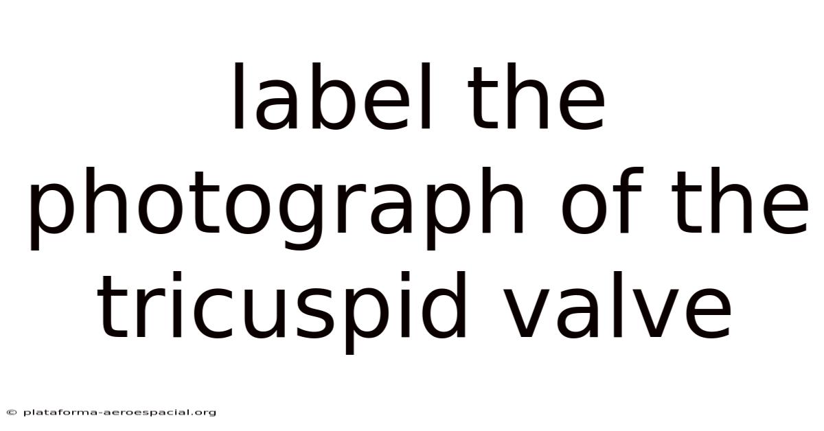 Label The Photograph Of The Tricuspid Valve