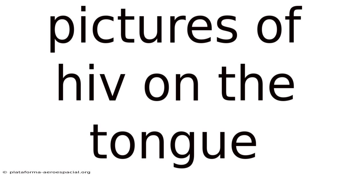 Pictures Of Hiv On The Tongue