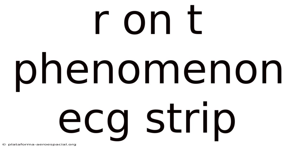R On T Phenomenon Ecg Strip