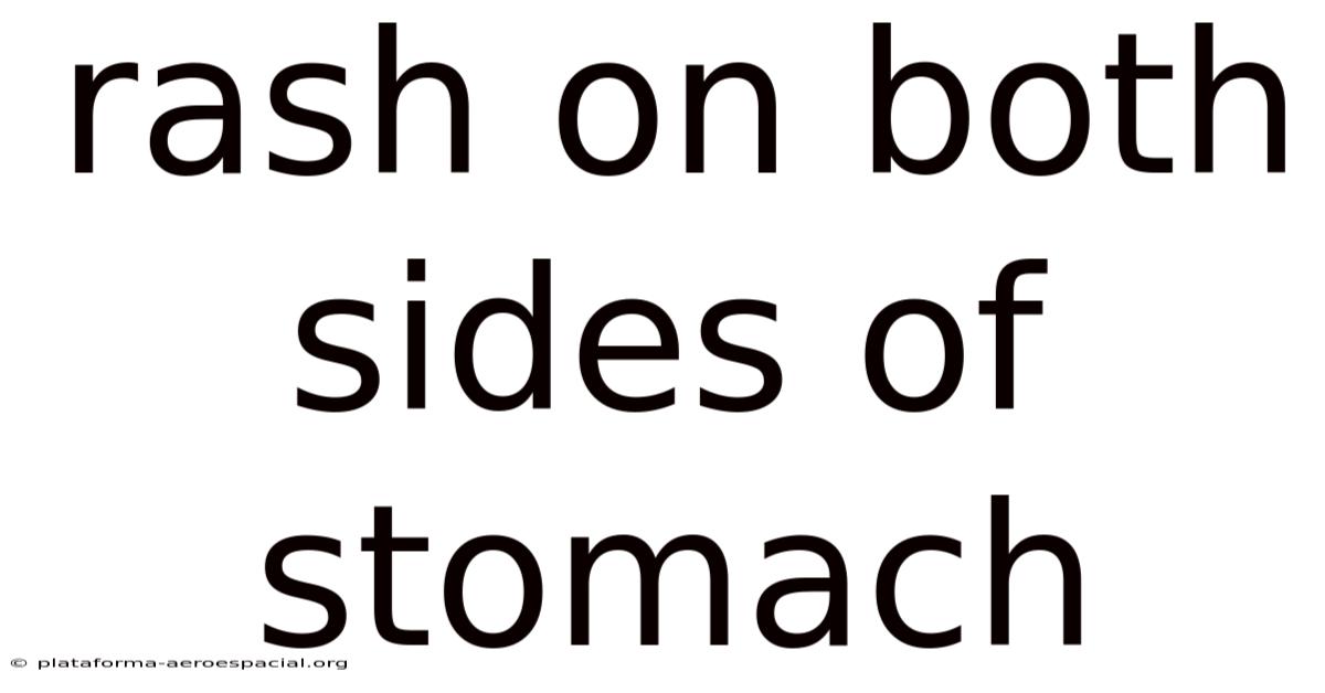 Rash On Both Sides Of Stomach