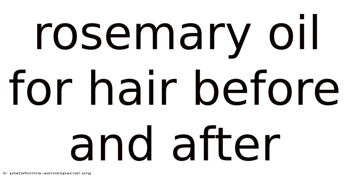 Rosemary Oil For Hair Before And After