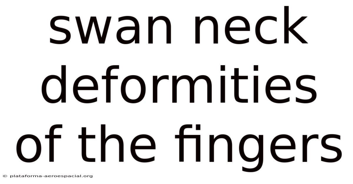 Swan Neck Deformities Of The Fingers