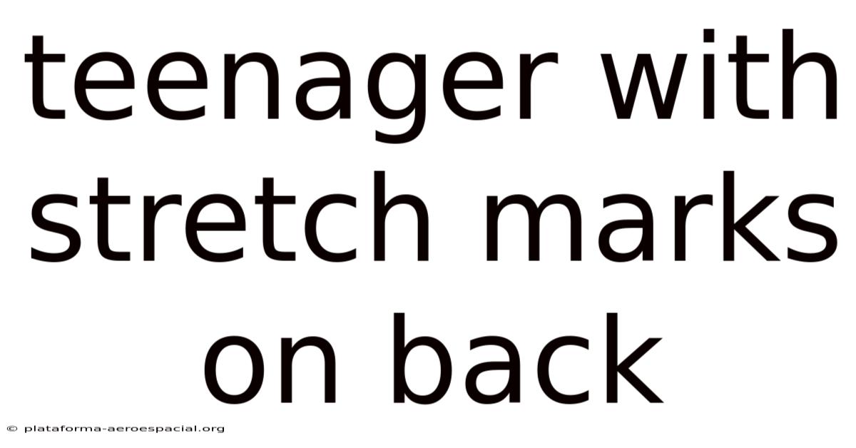 Teenager With Stretch Marks On Back