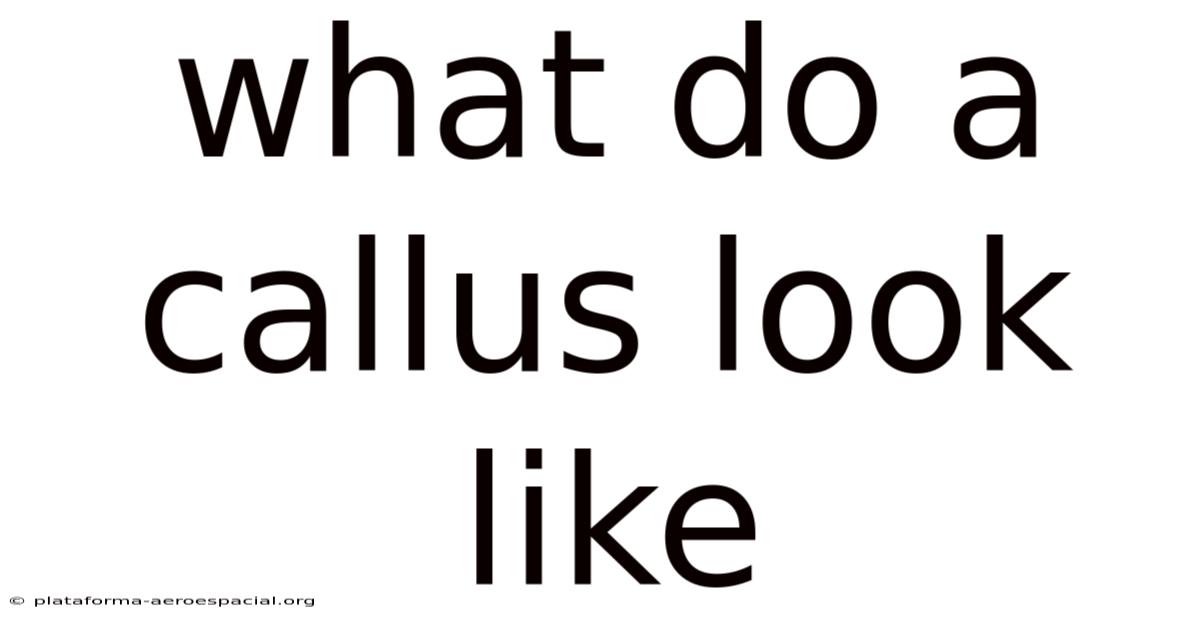 What Do A Callus Look Like