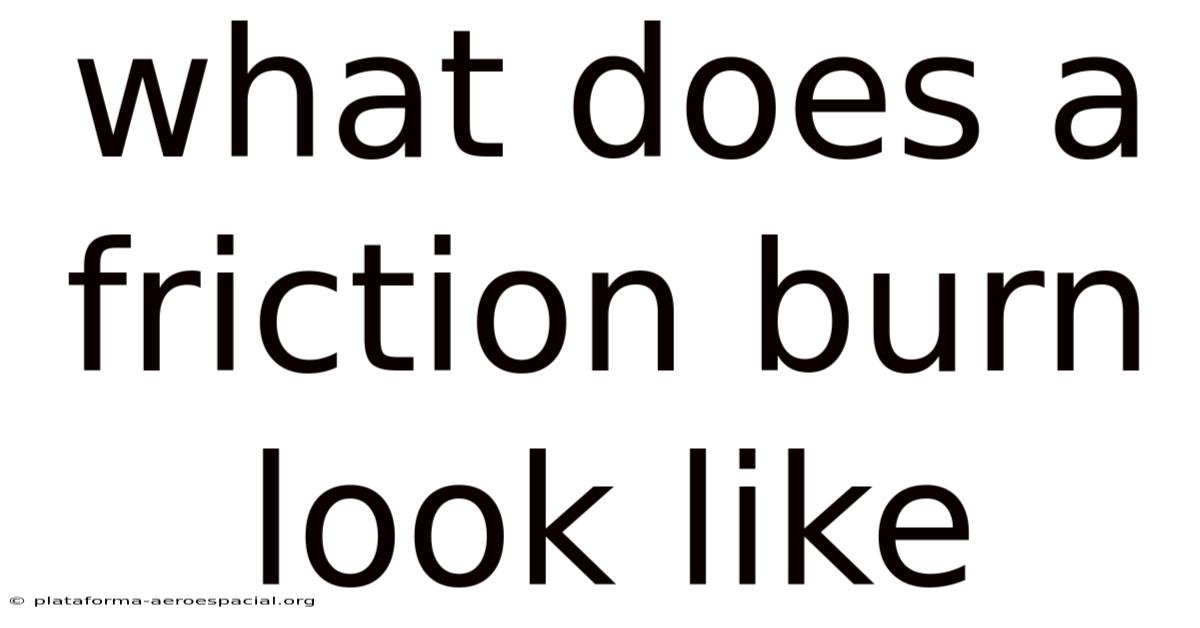 What Does A Friction Burn Look Like