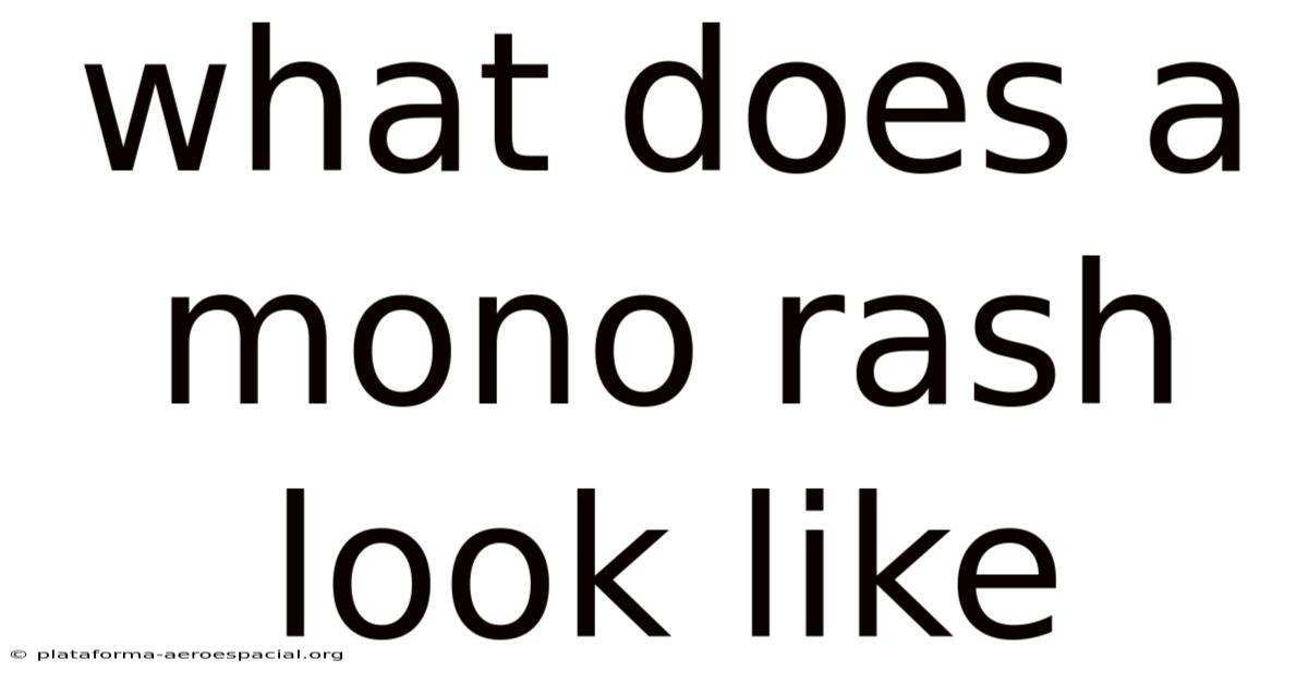 What Does A Mono Rash Look Like