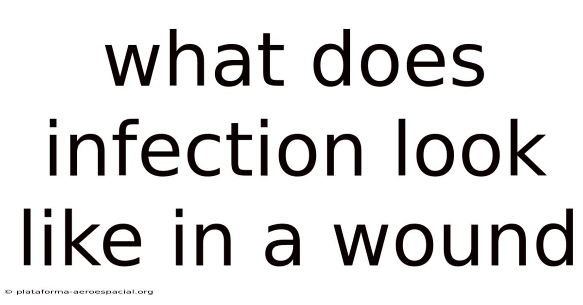 What Does Infection Look Like In A Wound