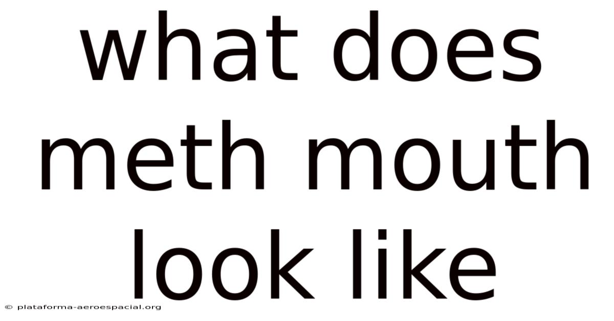 What Does Meth Mouth Look Like