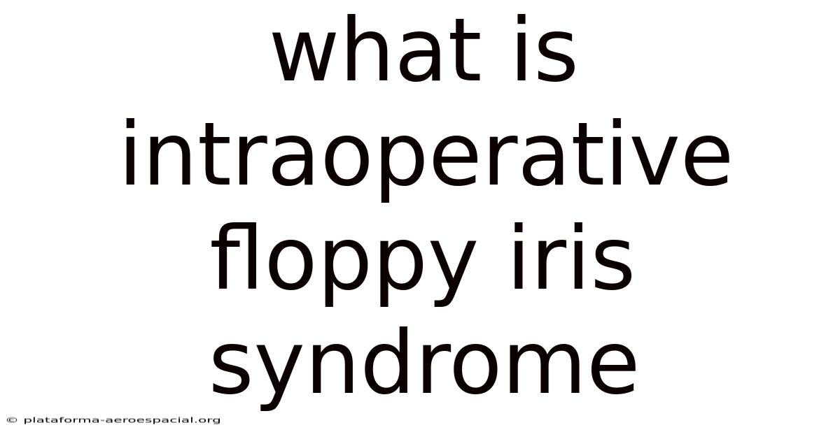 What Is Intraoperative Floppy Iris Syndrome